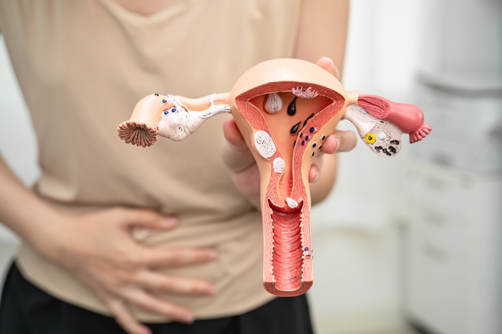 endometrióza léčba